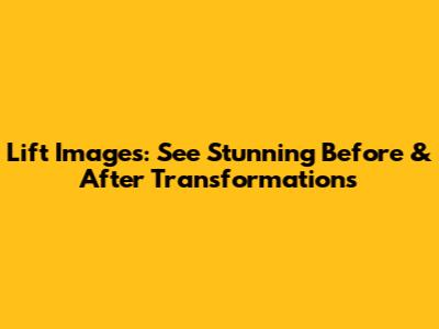 Lift Images: See Stunning Before & After Transformations
