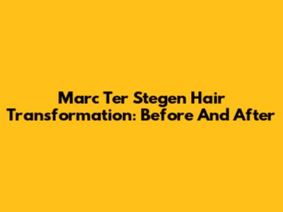 Marc Ter Stegen Hair Transformation: Before And After