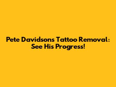 Pete Davidson's Tattoo Removal: See His Progress!