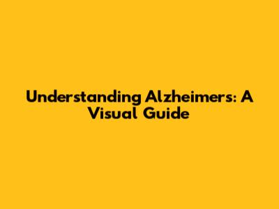 Understanding Alzheimer's: A Visual Guide