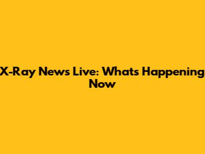X-Ray News Live: What's Happening Now